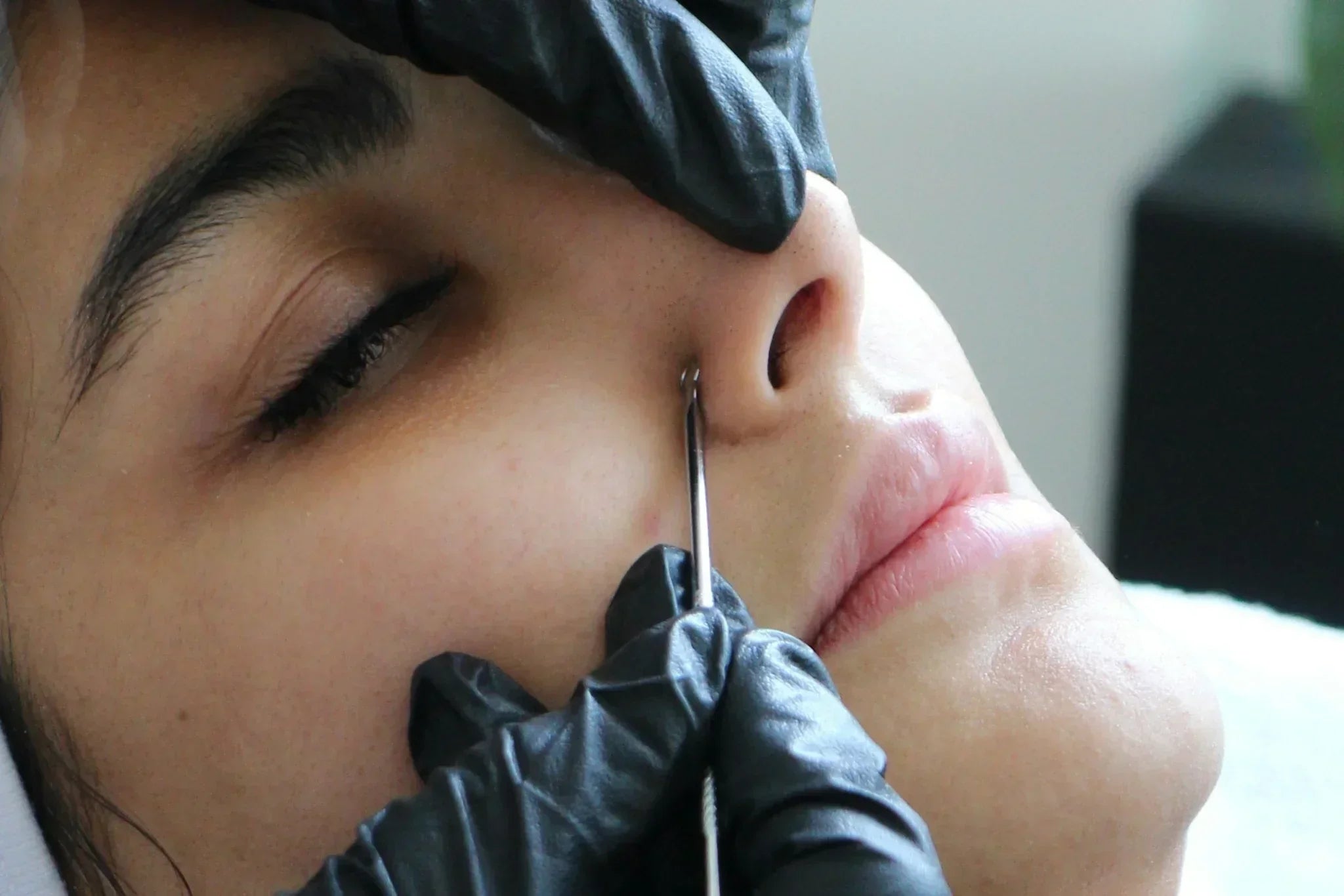 woman having extraction