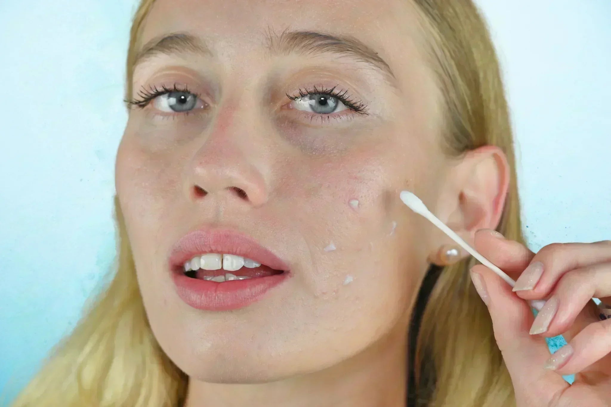 HOW TO TAKE CARE OF PROBLEM SKIN IN HOT, HUMID WEATHER