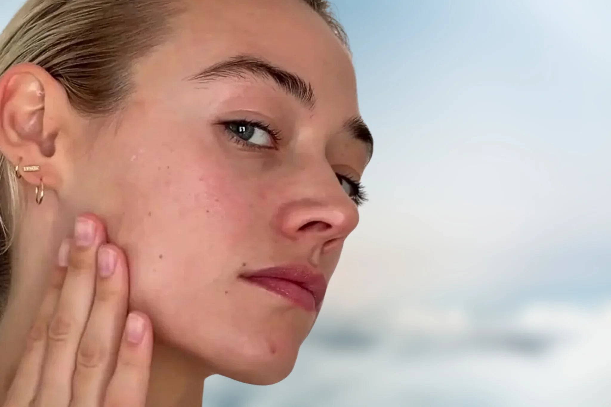 HOW TO HANDLE BREAKOUTS IN WARMER WEATHER