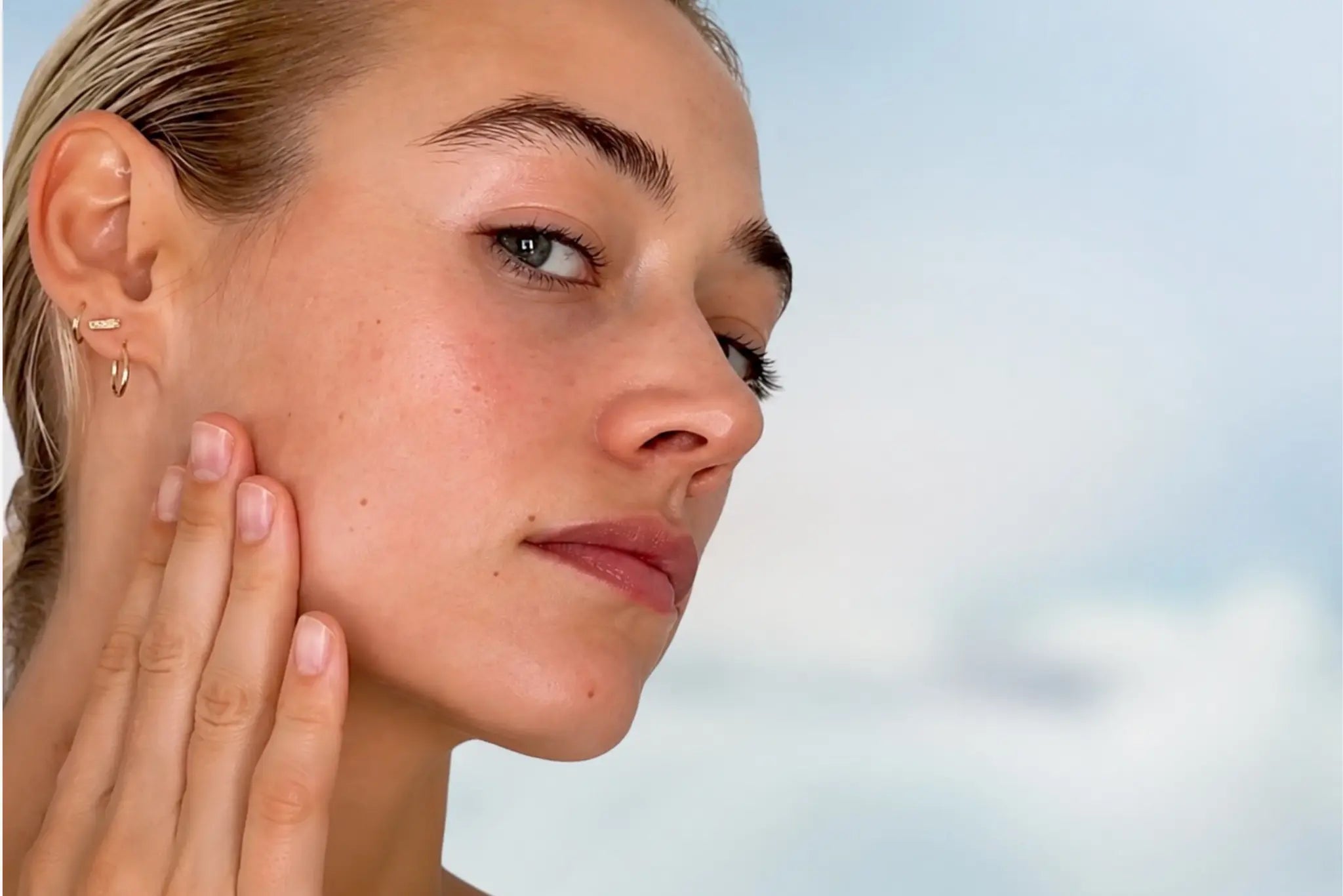 Woman with clear, healthy skin illustrating skincare for preventing breakouts during warm, humid weather.