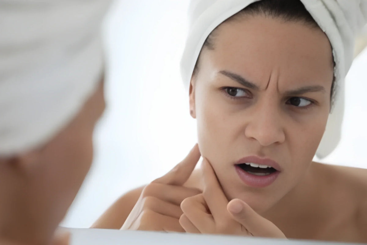 Woman looking closely at her skin in the mirror during a breakout, highlighting the connection between stress, inflammation, and skin health.