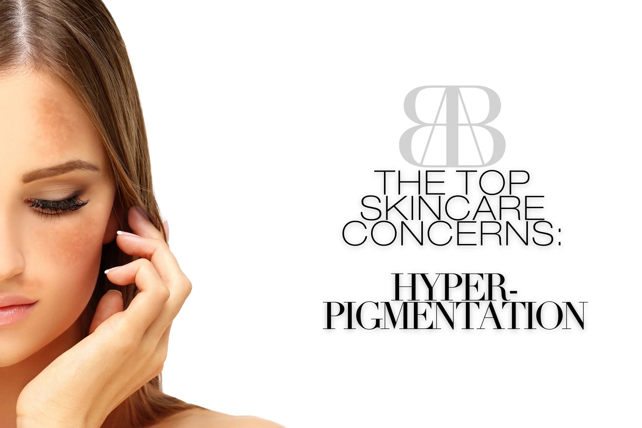 beauty with hyperpigmentation